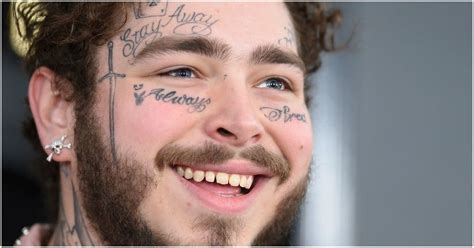 why does post malone have gold teeth